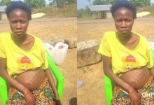 Pregnant woman wakes up to see strange hand mark on her stomach