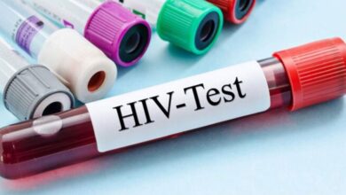 50 people contract HIV daily in Ghana – AIDS Commission reports