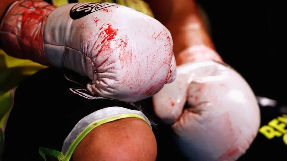 5. Boxing referee – Croatia (2014)