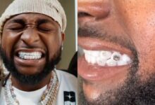 Davido reveals diamond teeth worth $500K, chain valued at $2M