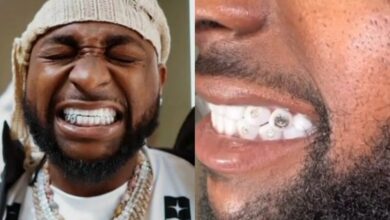Davido reveals diamond teeth worth $500K, chain valued at $2M