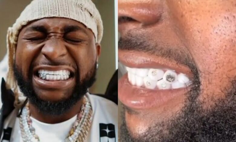 Davido reveals diamond teeth worth $500K, chain valued at $2M