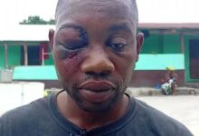 They shot me eight times, but nothing happened – Gold dealer reveals how he survived robbery attack