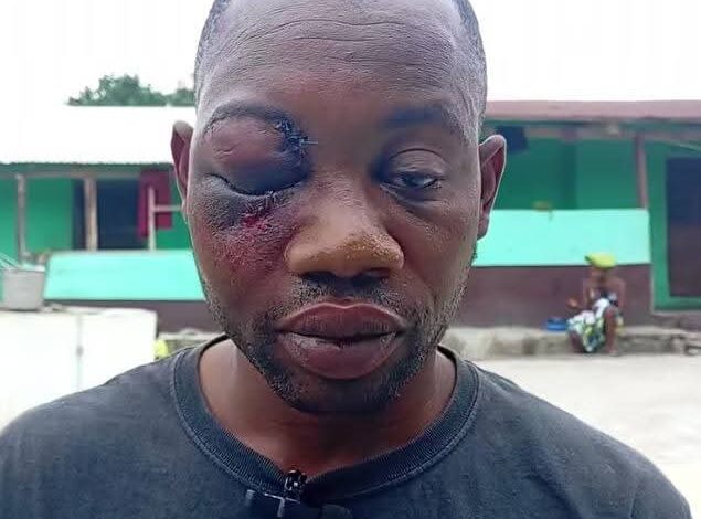 They shot me eight times, but nothing happened – Gold dealer reveals how he survived robbery attack