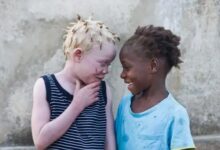 Persons with Albinism