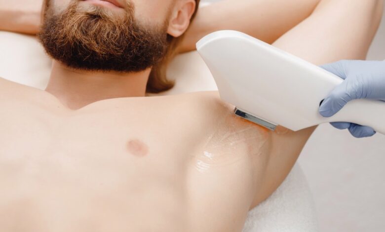 Why Full Body Laser Hair Reduction Is the Ultimate Time-Saver for Busy Professionals