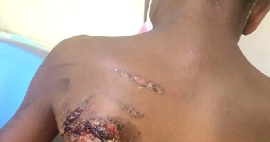 Ho mother on trial for burning son with hot iron