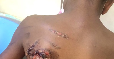 Ho mother on trial for burning son with hot iron