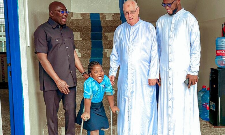 bawumia leprosy
