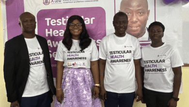 The testicle is the most hardworking organ of the male body