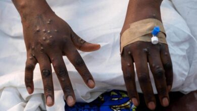 Ghana Health Service Issues Public Alert Following Marburg Virus Outbreak in Ethiopia