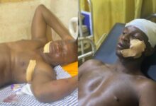 Five officers injured as Saawie mob disarms police