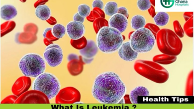 Ghana lacks adequate facilities to treat leukaemia –Ian Agbe appeals for support