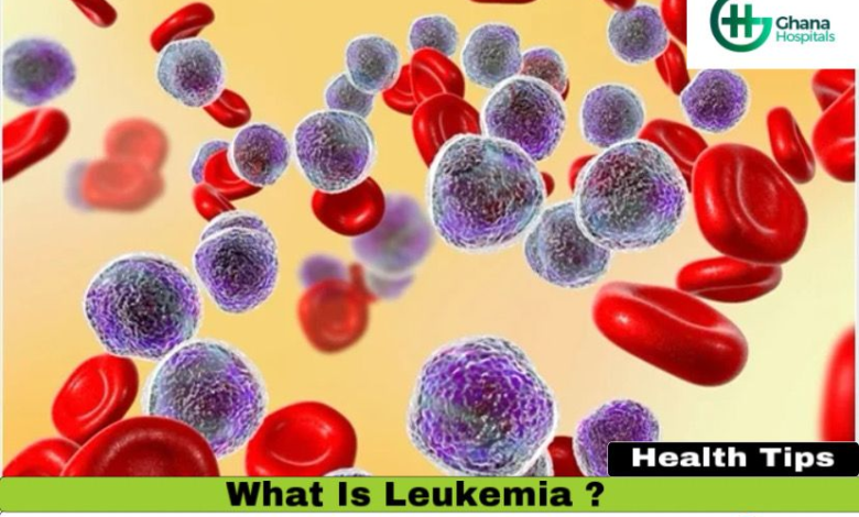 Ghana lacks adequate facilities to treat leukaemia –Ian Agbe appeals for support